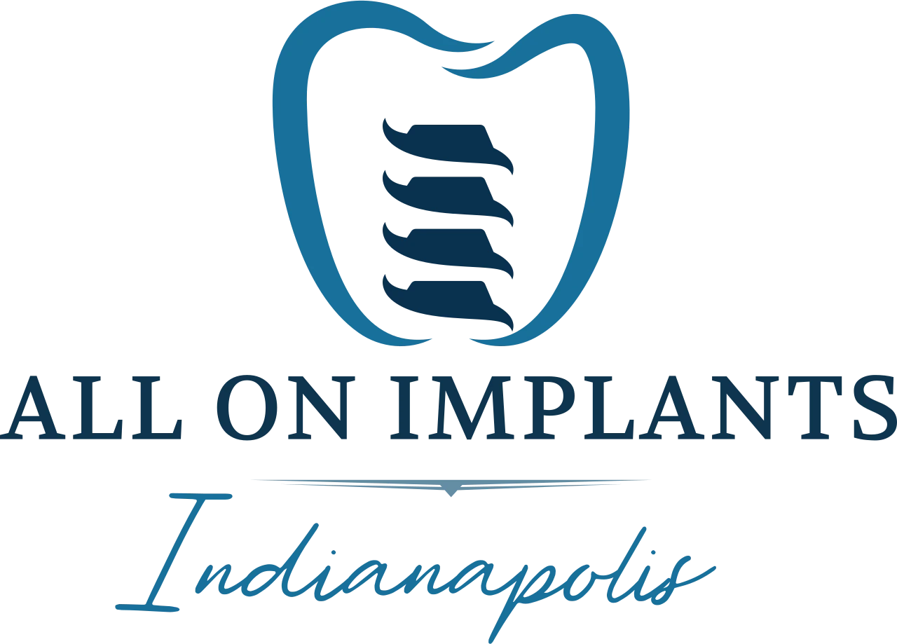 All On Implants Indianapolis logo